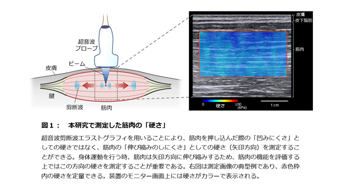 アスリートの筋肉の硬さが競技パフォーマンスに影響…順天堂