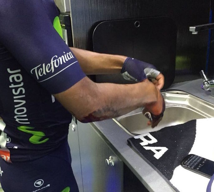 2015年ツール・ド・フランス第6ステージ、チームバスの中で傷を治療するナイロ・キンタナ（モビスター）