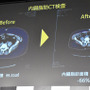 松村邦洋のライザップ前と後の腹部CT画像